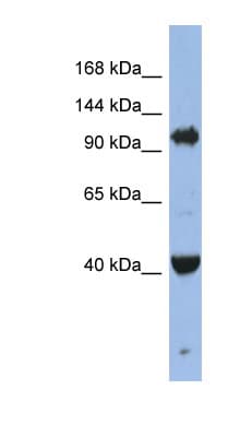 AGO4 / EIF2C4 Antibody (aa611-660)