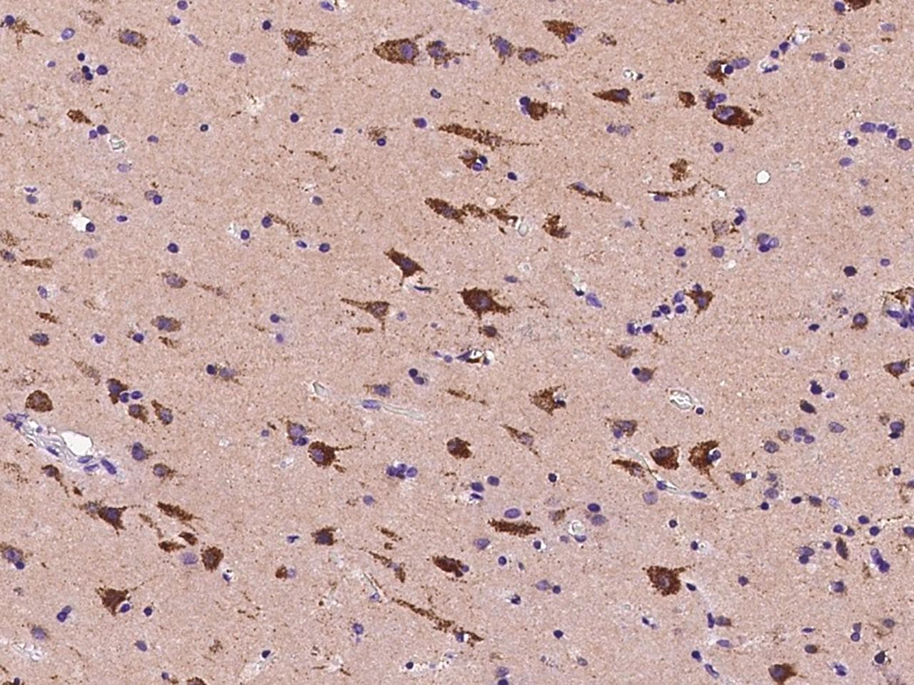CS1 / CLSTN1 Antibody (Preservative Free)