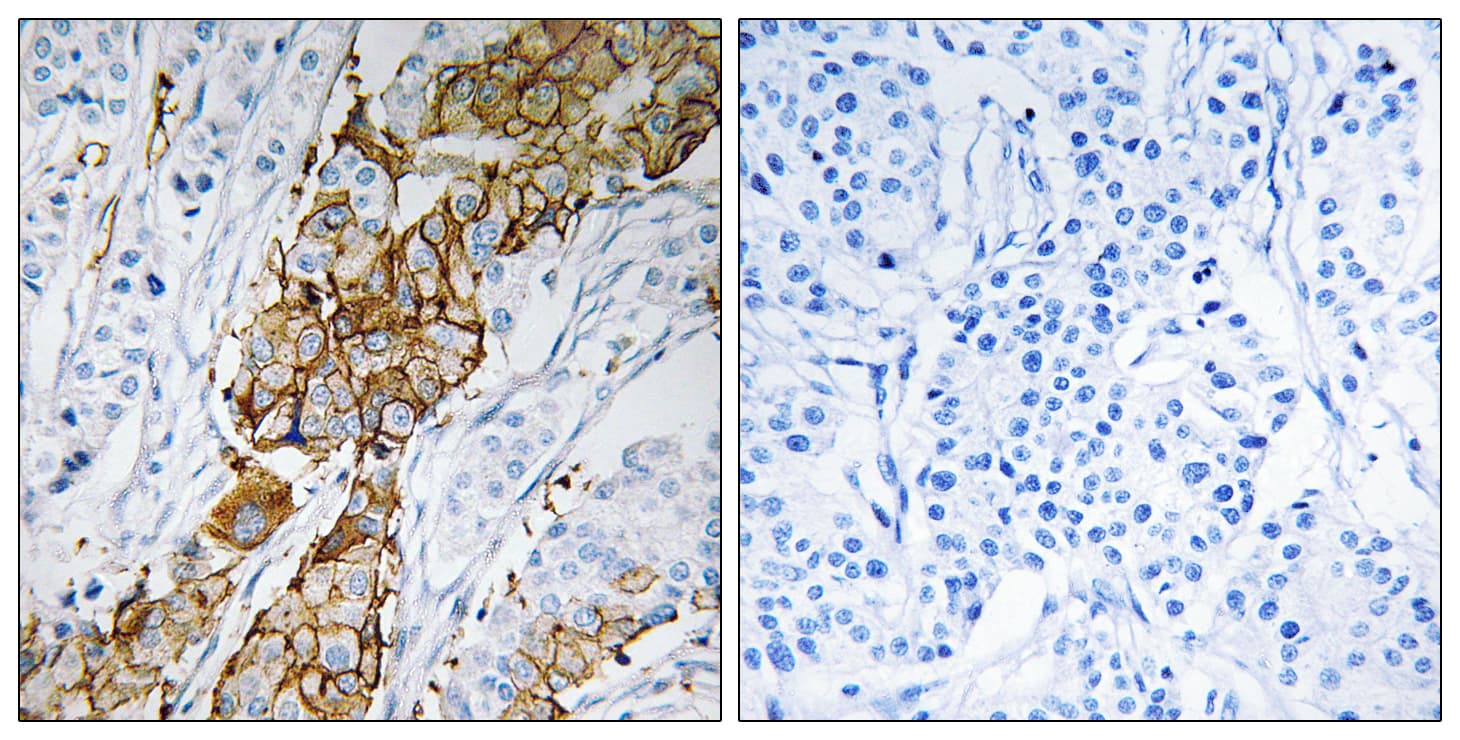 USP32 Antibody (aa271-320)