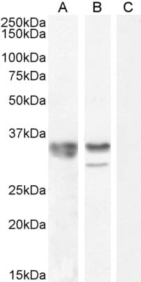 IHC-plus™ Polyclonal Goat anti-Human HNRNPA2B1 Antibody (aa127-137, IHC, WB)