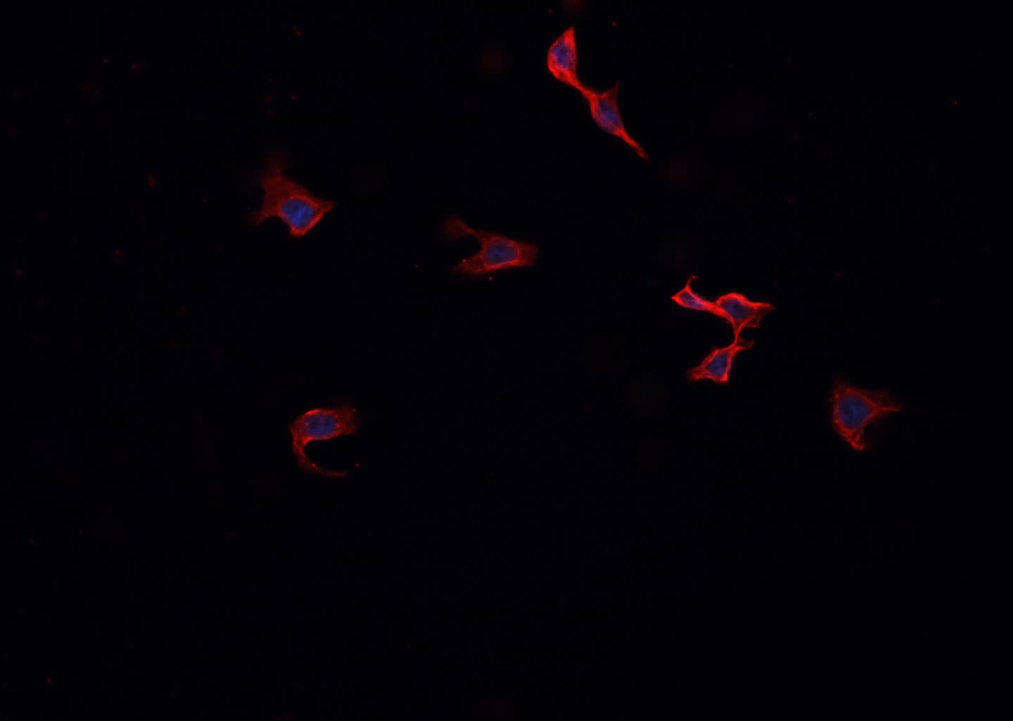 PRKCZ / PKC-Zeta Antibody