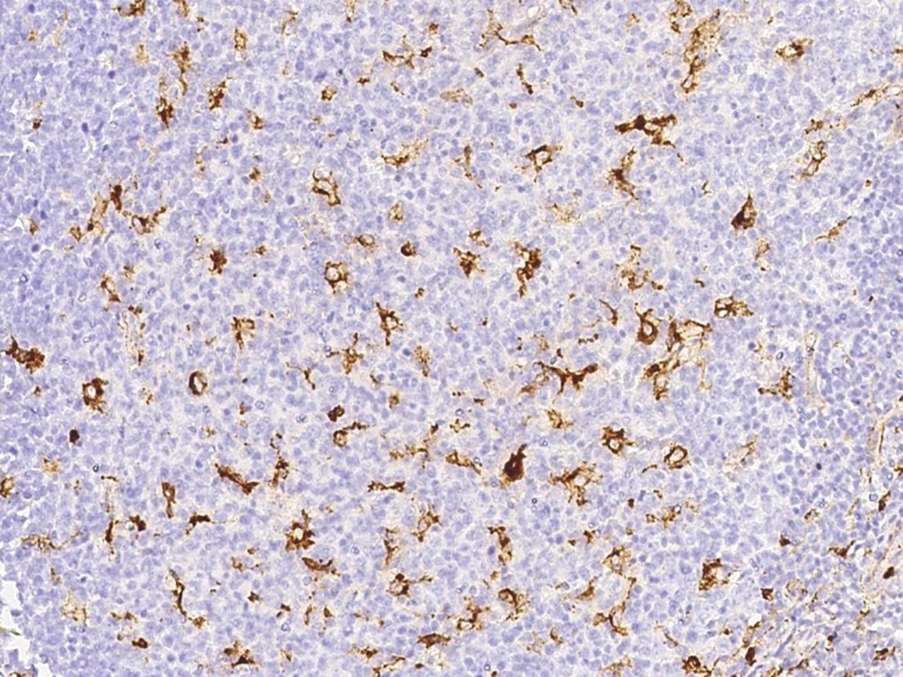 MMP9 / Gelatinase B Antibody (Preservative Free)