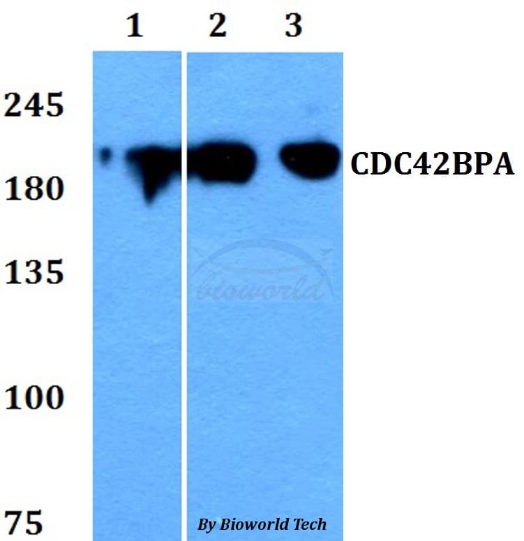 CDC42BPA / MRCK Antibody