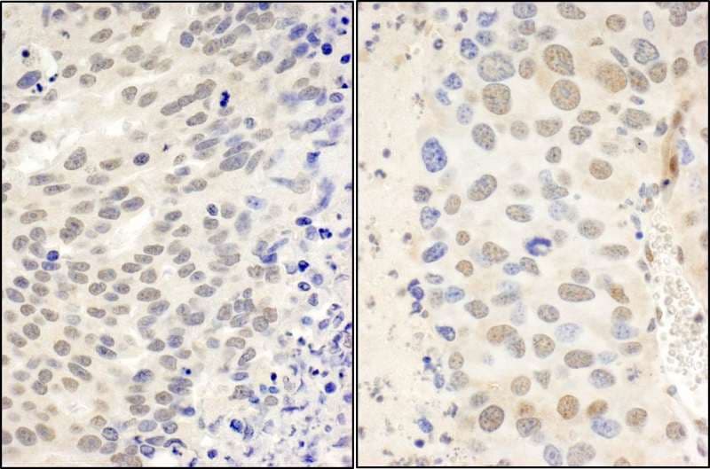 CTCF Antibody (aa650-700)