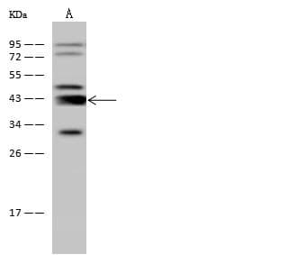 ADA / Adenosine Deaminase Antibody