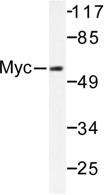 Polyclonal Rabbit anti-Human MYC / c-Myc Antibody (Lys52, IHC, WB)