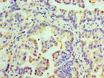 Polyclonal Rabbit anti-Human RMDN3 Antibody (aa1-470, IHC)