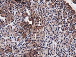 NUDT6 Antibody (clone OTI9D12)