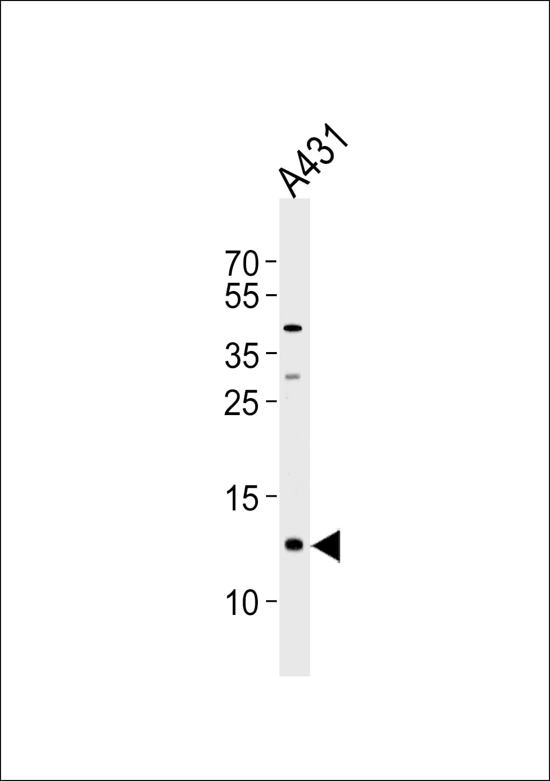Polyclonal Rabbit anti-Human SPRR2A Antibody (aa48-72, WB)