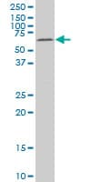 Monoclonal Mouse anti-Human MAK Antibody (clone 3E5, IF, WB)