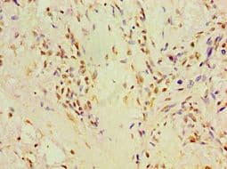 Polyclonal Rabbit anti-Human P4HA2 Antibody (aa236-535, IHC, WB)