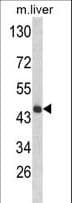 Polyclonal Rabbit anti-Human HPD Antibody (aa92-121, IHC, WB)