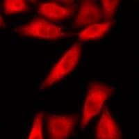 TOPBP1 Antibody