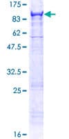 Human MASP2 / MASP-2 Protein (Recombinant GST)