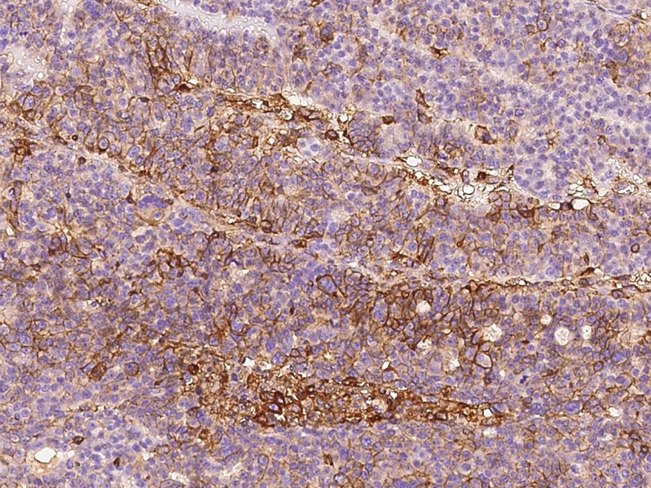 B2M / Beta 2 Microglobulin Antibody (clone 34, Preservative Free)