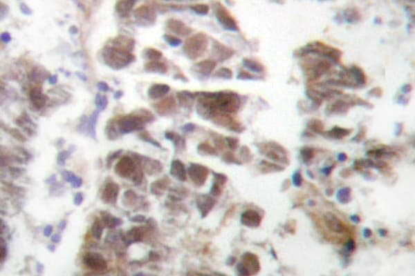 GATA4 Antibody (Pro101)