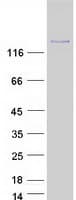 Human COBL Protein (Recombinant Myc-DDK (Flag))