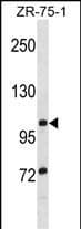 TTLL8 Antibody (aa 74-102, N-term)