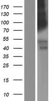 LRRN4 / C20orf75 Protein (Over-Expression Lysate Myc-DDK (Flag))