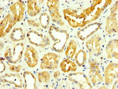 GPT / Alanine Transaminase Antibody (aa2-496)