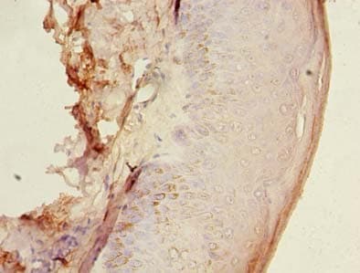HEMK1 Antibody