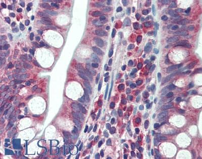 IHC-plus™ PGRMC2 Antibody (aa173-223)