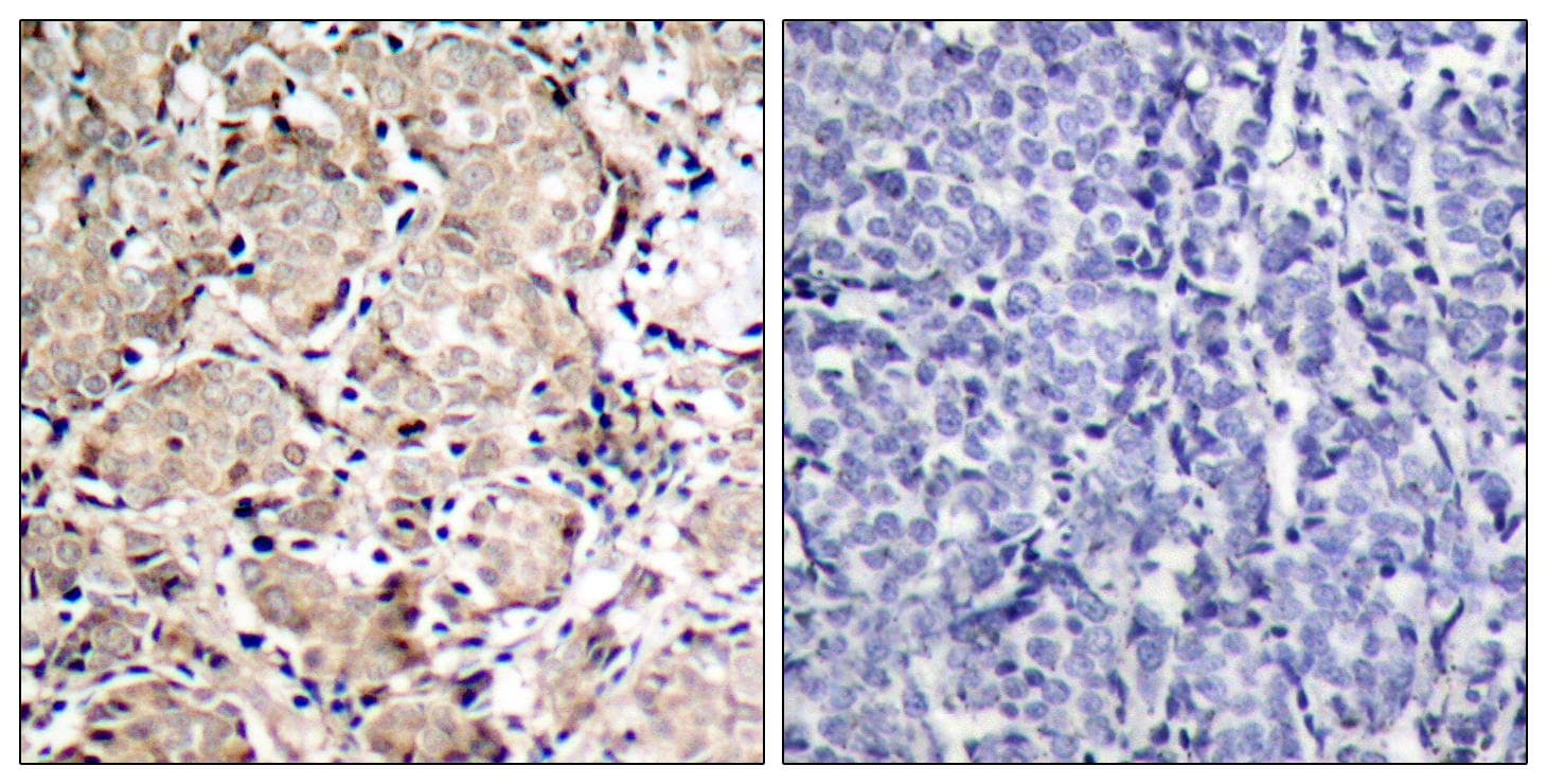 FOXO1 / FKHR Antibody (phospho-Ser319)