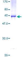 Human DCAF7 / WDR68 Protein (Recombinant GST)