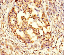 Polyclonal Rabbit anti-Human GPX8 Antibody