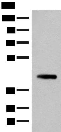 SMS / Spermine Synthase Antibody