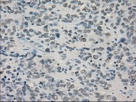 CRYAB / Alpha B Crystallin Antibody (clone OTI3C2)