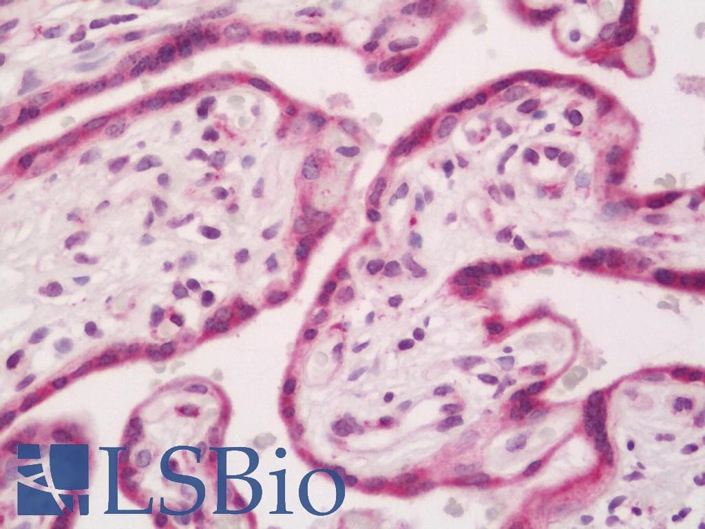 IHC-plus™ Polyclonal Rabbit anti-Human DUSP9 Antibody (aa140-184, IHC, IF, WB)