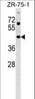 Polyclonal Rabbit anti-Human ZNF323 Antibody (aa190-217, WB)
