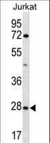 OR6T1 Antibody (aa244-272)