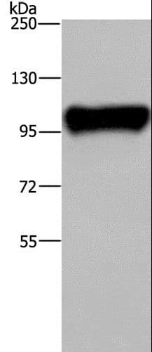 PTK2B / PYK2 Antibody