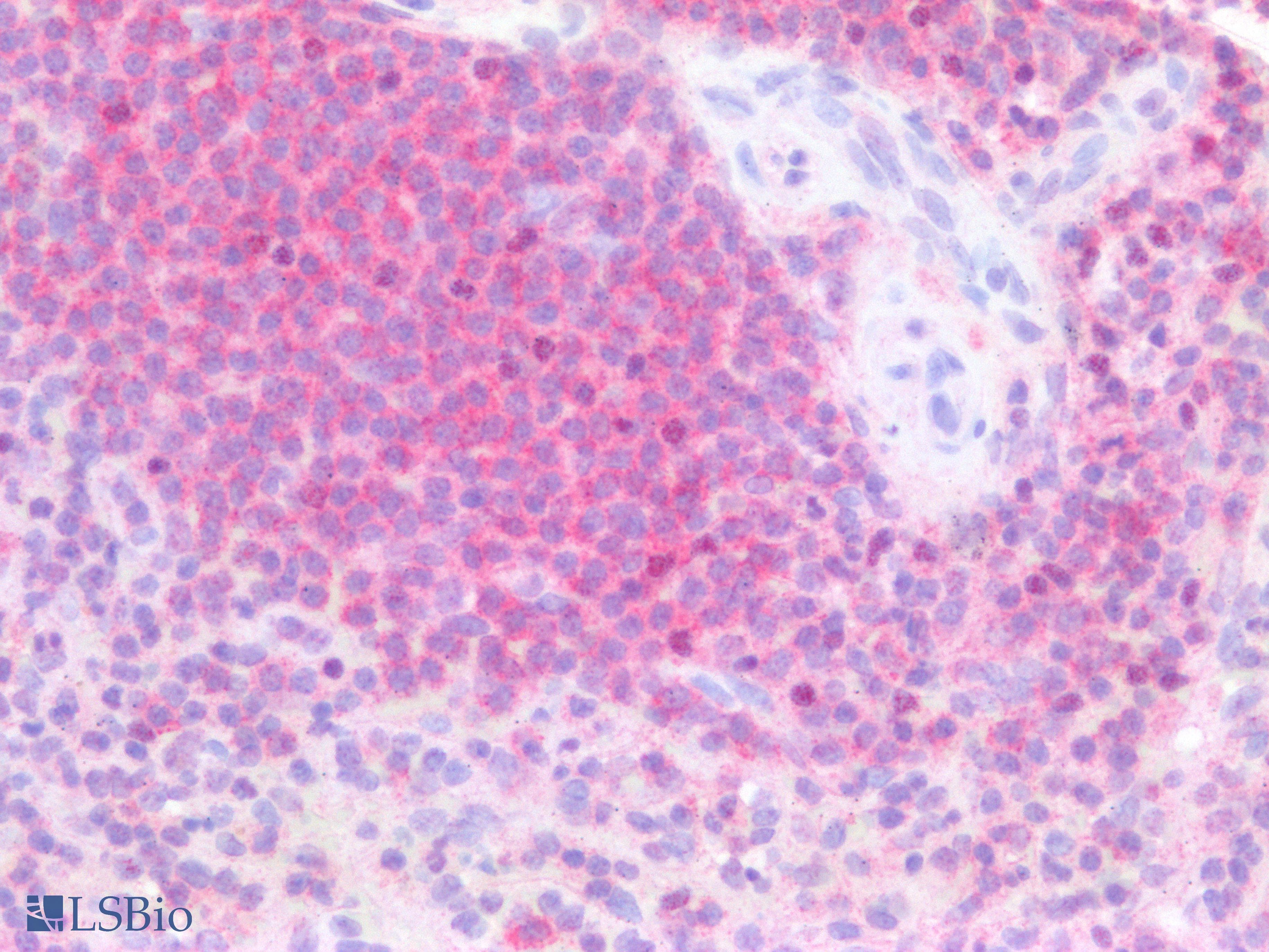 IHC-plus™ Monoclonal Mouse anti-Human CD79B / CD79 Beta Antibody (clone CB3-1, IHC, WB)