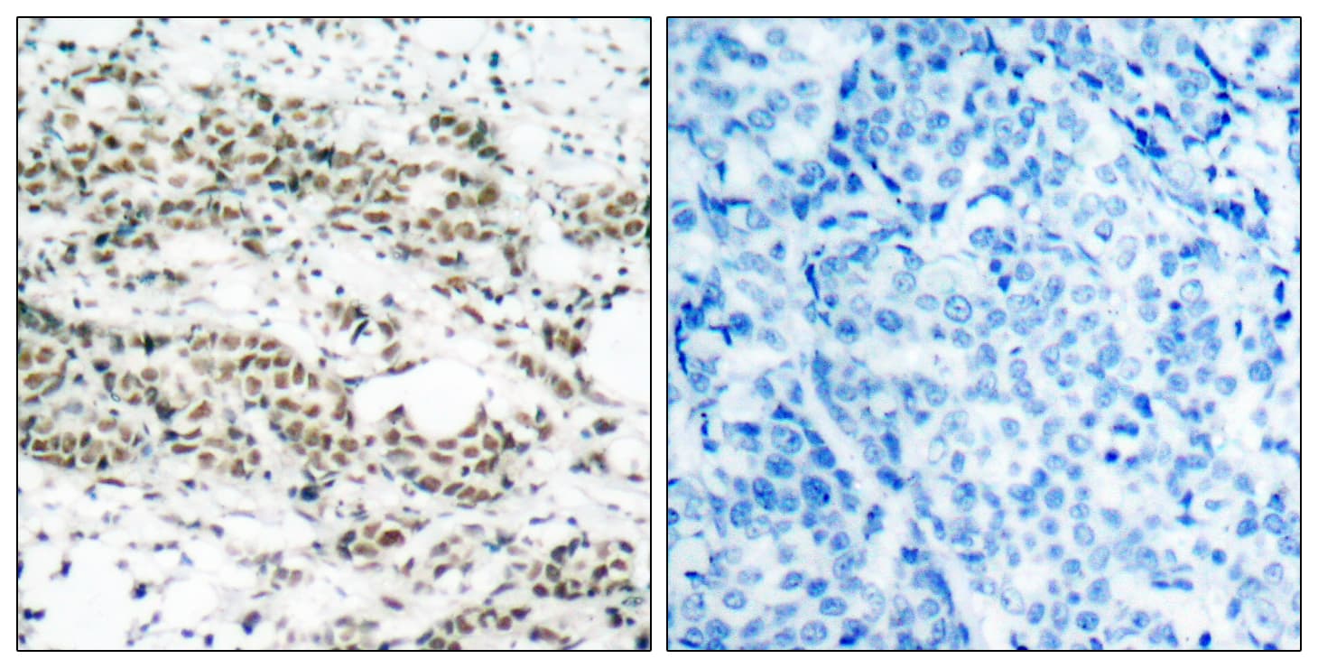 Polyclonal Rabbit anti-Human FOXO4 / AFX1 Antibody (phospho-Ser197, IHC, WB)