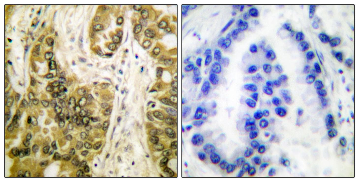 LGALS3 / Galectin 3 Antibody