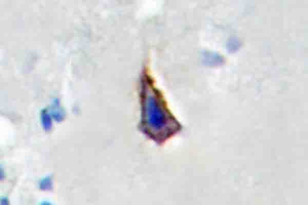 AQP2 / Aquaporin 2 Antibody (Arg252)