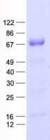 Human NFKBIE / IKB Epsilon Protein (Recombinant His, N-Terminal)