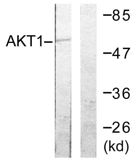 AKT1 Antibody (p72)