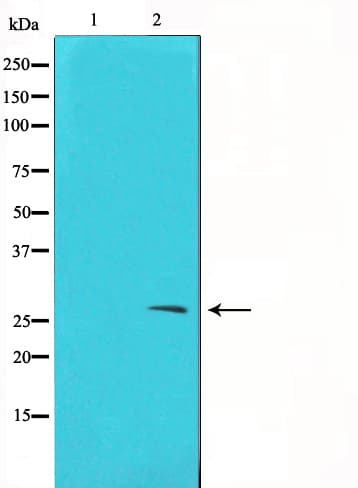 TIMP2 Antibody
