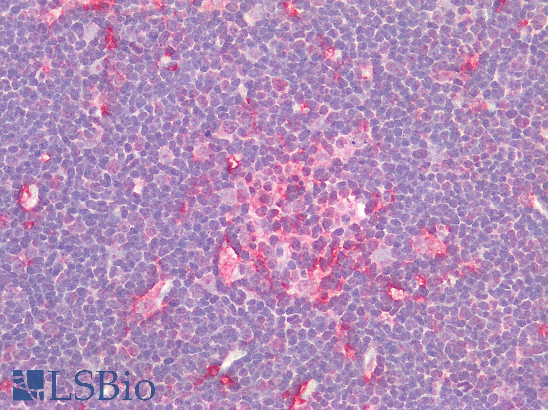 IHC-plus™ Polyclonal Rabbit anti-Human AIF1 / IBA1 Antibody (N-Terminal, IHC)