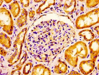 Polyclonal Rabbit anti-Human CLDN6 / Claudin 6 Antibody (IHC)