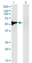 Monoclonal Mouse anti-Human UGDH / UDPGDH Antibody (clone 1B7, WB)