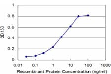 Monoclonal Mouse anti-Human SCAMP3 Antibody (clone 1F6, WB)