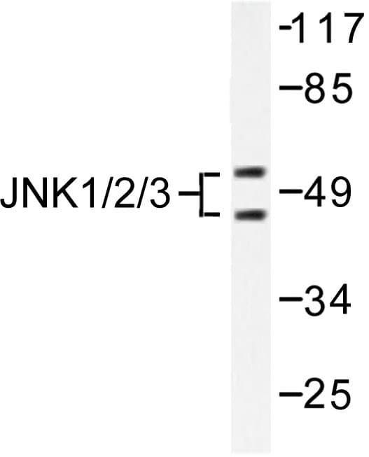 Polyclonal Rabbit anti-Human JNK1+2+3 Antibody (Thr178, IHC, IF, WB)