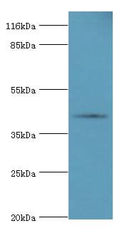 SERPINB8 Antibody