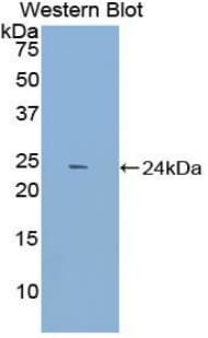 DNM1 / Dynamin Antibody (aa572-745)