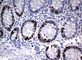 Monoclonal Mouse anti-Human MKI67 / Ki67 Antibody (clone OTI3B6, IHC)